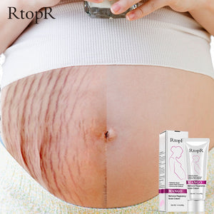 Mango Remove Pregnancy Scars Cream -Stretch Marks Treatment - Tania's Online Closet, LLC